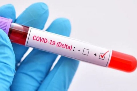 Coronavirus: ¿Cuándo una persona positiva de Covid-19 deja de contagiar?