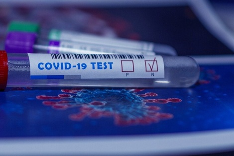 Qué es Flurona, la infección de Covid-19 y gripe, y cuáles son sus síntomas