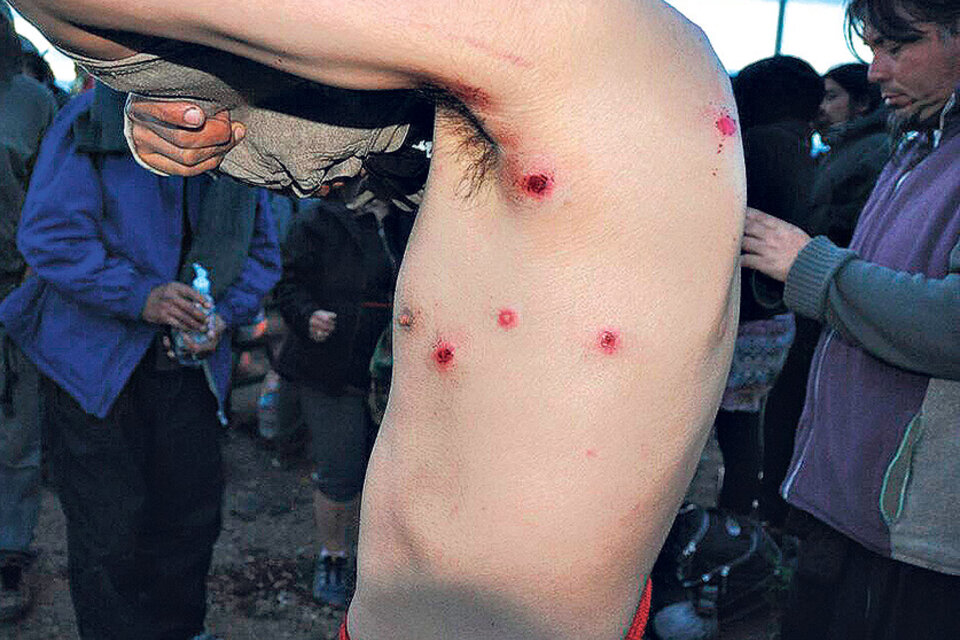 La violenta represión a los mapuches dejó varios heridos, dos de ellos de gravedad.