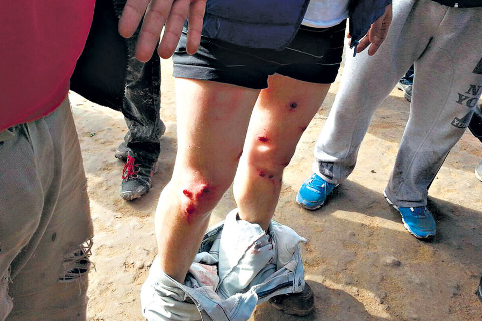 Heridas por la represión a los trabajadores del Ingenio Ledesma en Jujuy en julio del año pasado. 