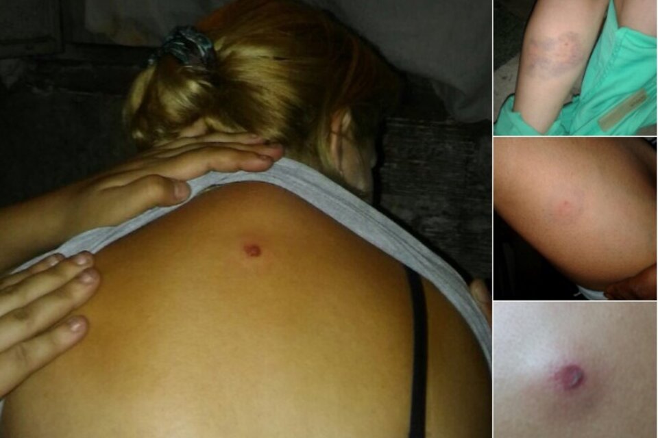 Hubo varias mujeres heridas por las balas de goma de la Bonaerense. (Fuente: Twitter: @mayrasmendoza)