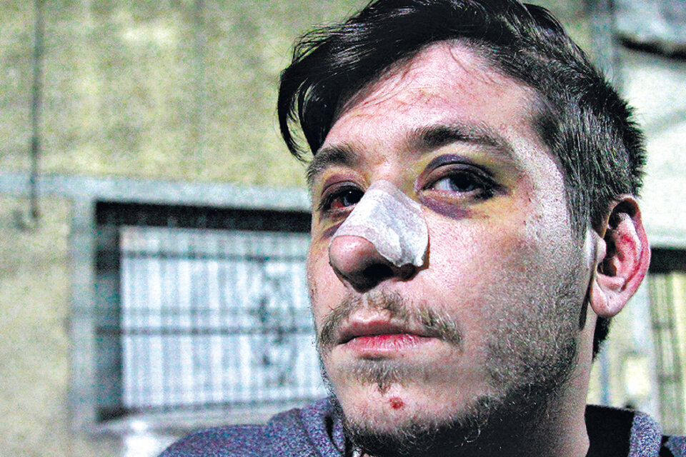 Alan Juárez quedó inconsciente por las patadas en la cabeza que recibió de los policías. (Fuente: Jorge Larrosa)