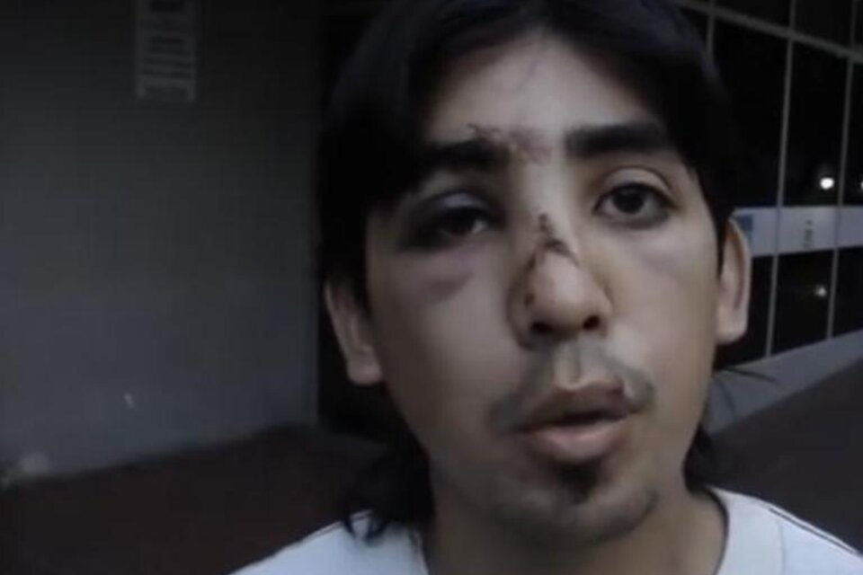 Abel, el joven que sufrió golpes de parte de la policía mendocina. (Fuente: Captura de pantalla)
