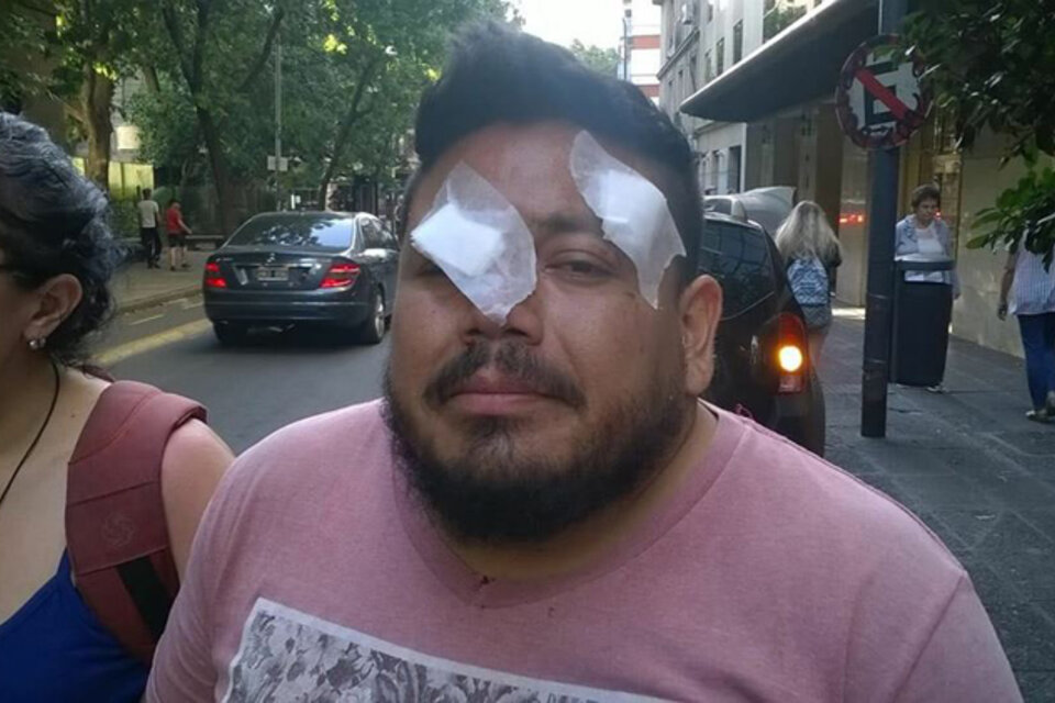Daniel Sandoval, una de las víctimas de la represión policial el lunes pasado. (Fuente: Twitter @valeriafgl)