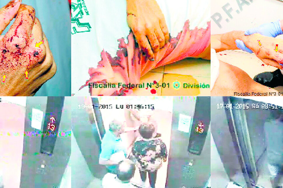Sangre y restos de conflagración en las manos de Nisman. El ascensor de servicio, con las cámaras que sí funcionaban.