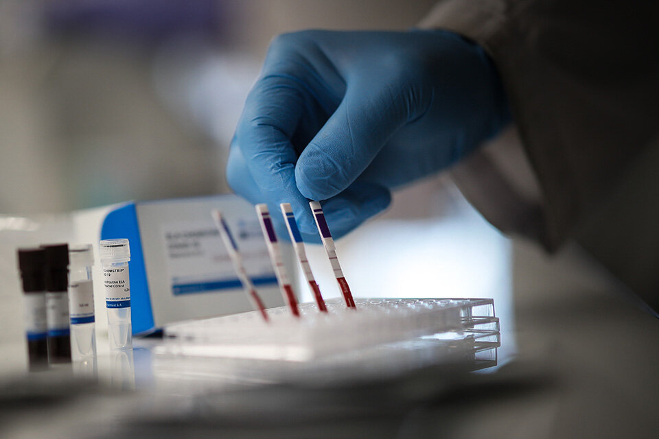 El sistema que se estudia en la UNR es alternativo al PCR en tiempo real (Fuente: EFE)