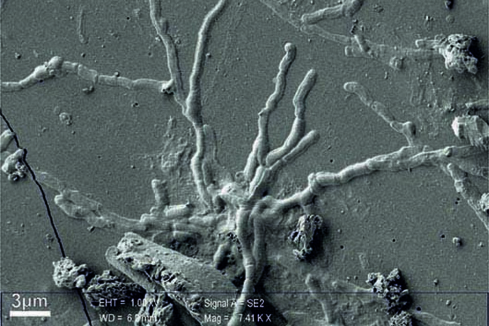La imagen de las neuronas vitrificadas del cerebro y la médula espinal de una víctima de la erupción del Vesubio. (Fuente: DPA)