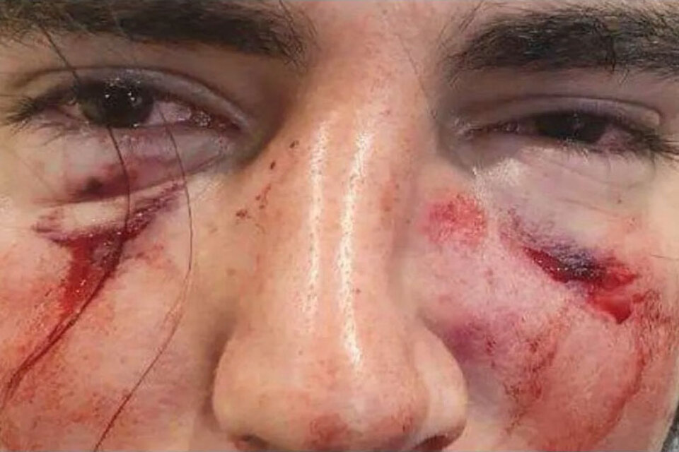 Así quedó Lautaro Insúa, el joven golpeado por rugbiers del Tala Rugby Club de Córdoba.