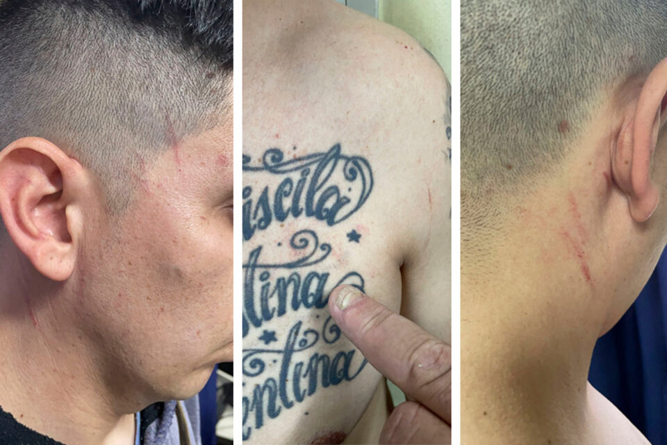 El detenido tenía varios arañazos en la cara y la nunca y dijo ser el autor del crimen. (Fuente: Télam)