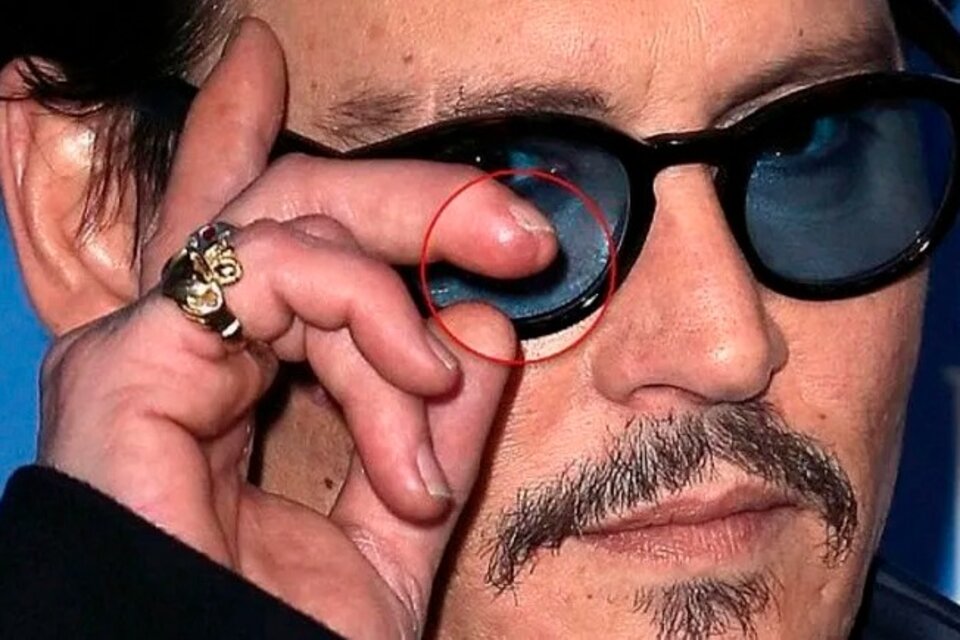 El médico de Johnny Depp dice que encontró el dedo del actor en la escena de una pelea