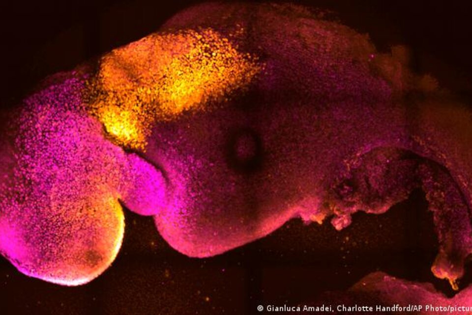 Al observar los embriones en un laboratorio en lugar de un útero, los científicos obtuvieron una mejor visión del proceso para saber por qué algunos embarazos pueden fallar y cómo prevenirlo. (Foto: AP)
