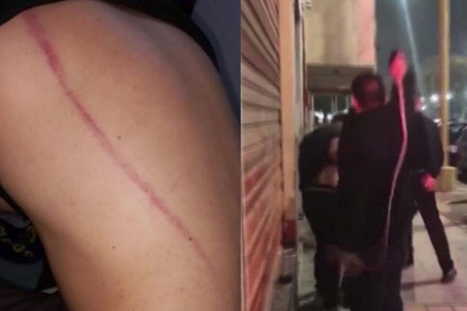 Patovicas de un boliche en Tucumán atacaron a latigazos a una pareja, Uno de ellos quedó con prisión preventiva. 