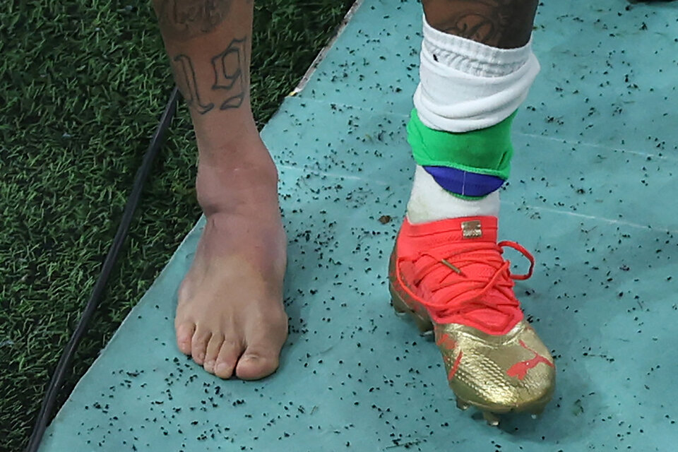 Así quedó el tobillo de Neymar por la lesión que sufrió durante el debut en Qatar 2022. (Fuente: AFP)