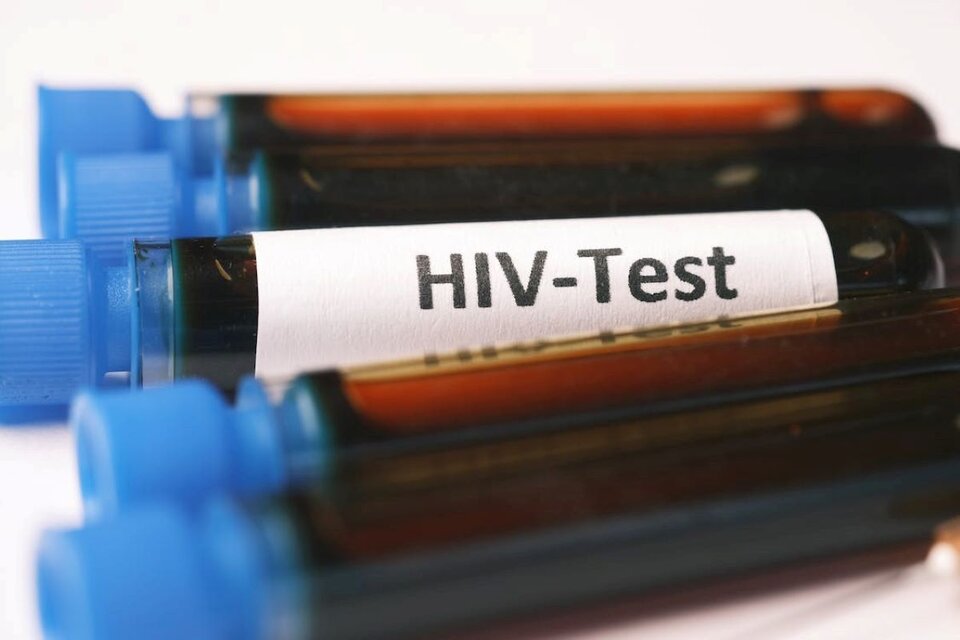 Se conoció el sexto caso de remisión del HIV. Imagen: Pexels