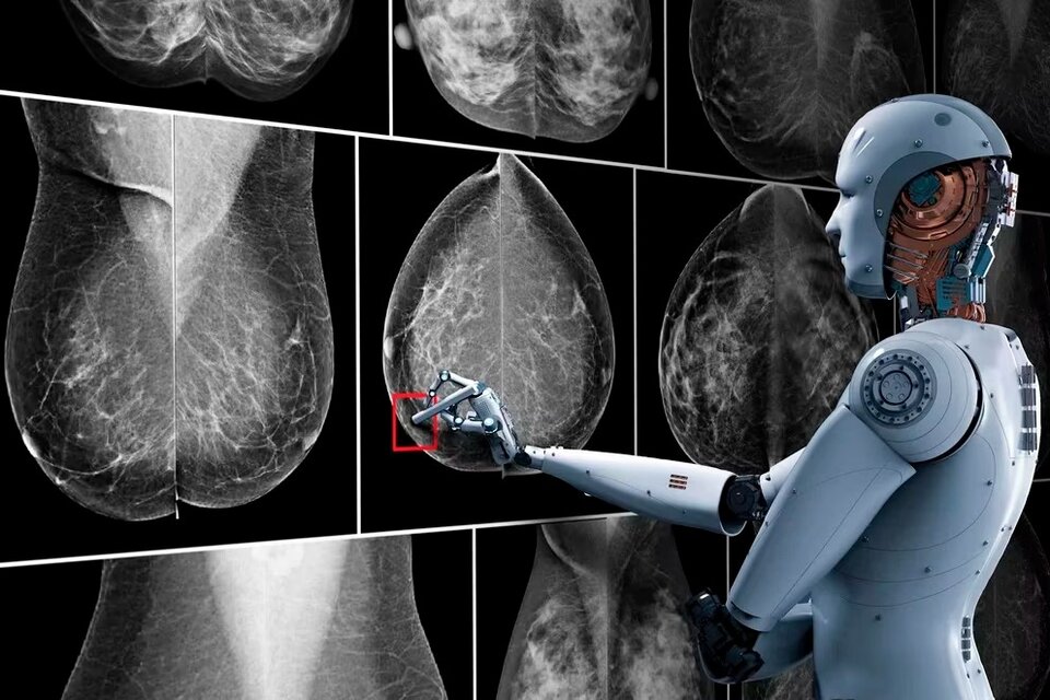 Cáncer de mama: crean un software con inteligencia artificial para identificarlo con mayor precisión