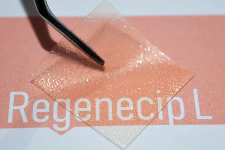 Al ser transparente, la membrana permite ver si la herida supura o cambia el color. (Fuente: GIT-Farma)