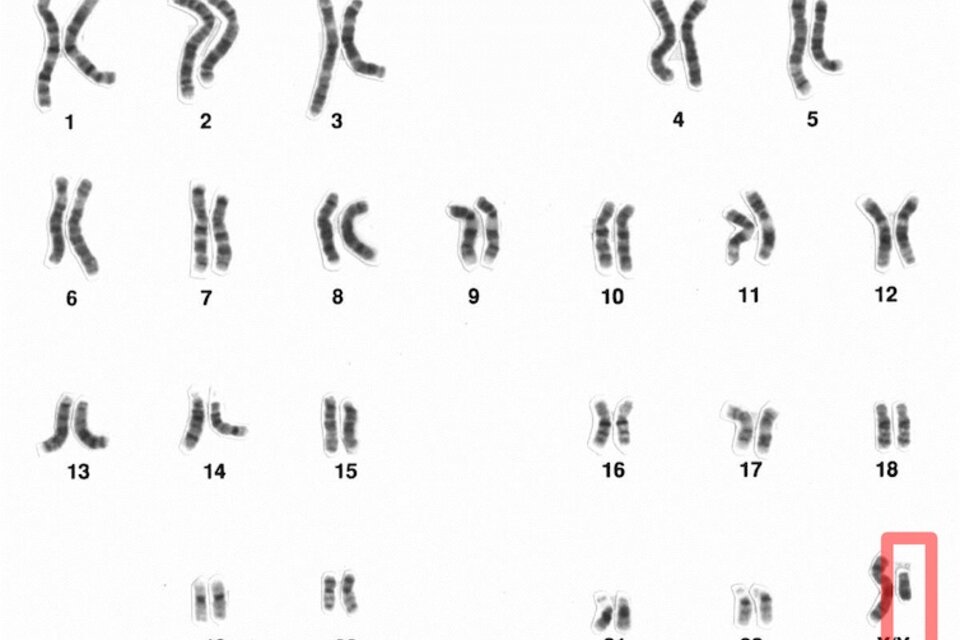 La secuenciación definitiva del cromosoma Y añade 30 millones de bases nuevas a la referencia del genoma humano (Fuente: National Human Genome Research Institute)
