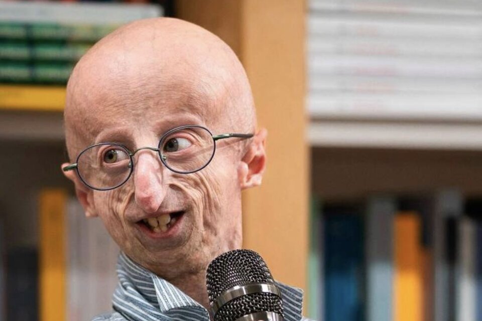 Nacido en 1995 en Schio, con dos años le diagnosticaron la progeria de Hutchinson-Gilford, una enfermedad genética extremamente rara que provoca el envejecimiento prematuro y acelerado (Fuente: AFP)