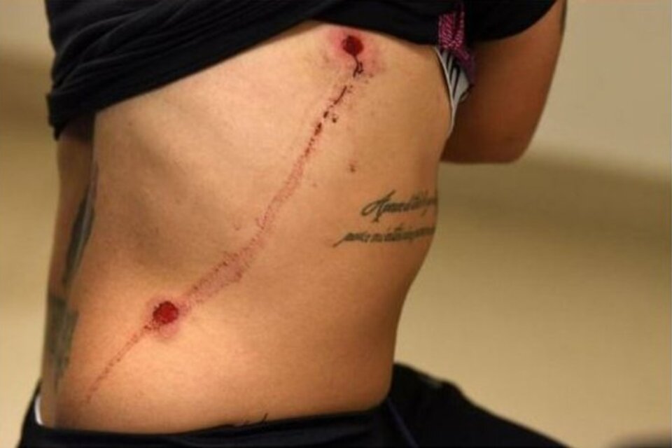 Rocío Correa muestra sus heridas.  (Fuente: Twitter)