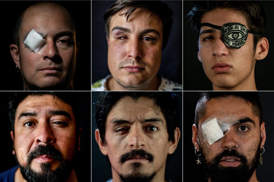 Retratos de victimas de perdigones disparados por carabineros (Fuente: AFP)