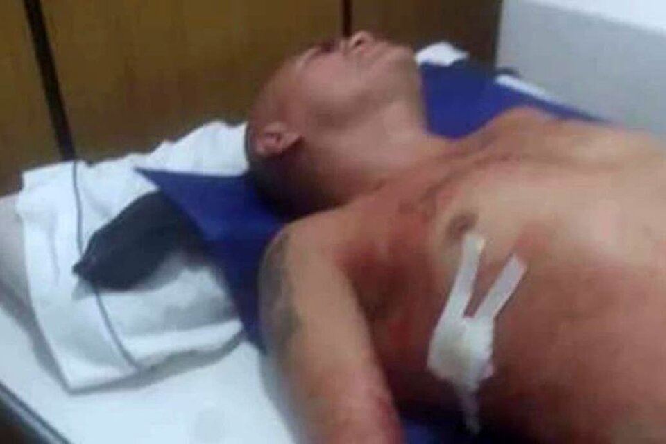 El boxeador Rodrigo "La Hiena" Barrios recibió heridas leves al ser apuñalado esta madrugada en Córdoba.