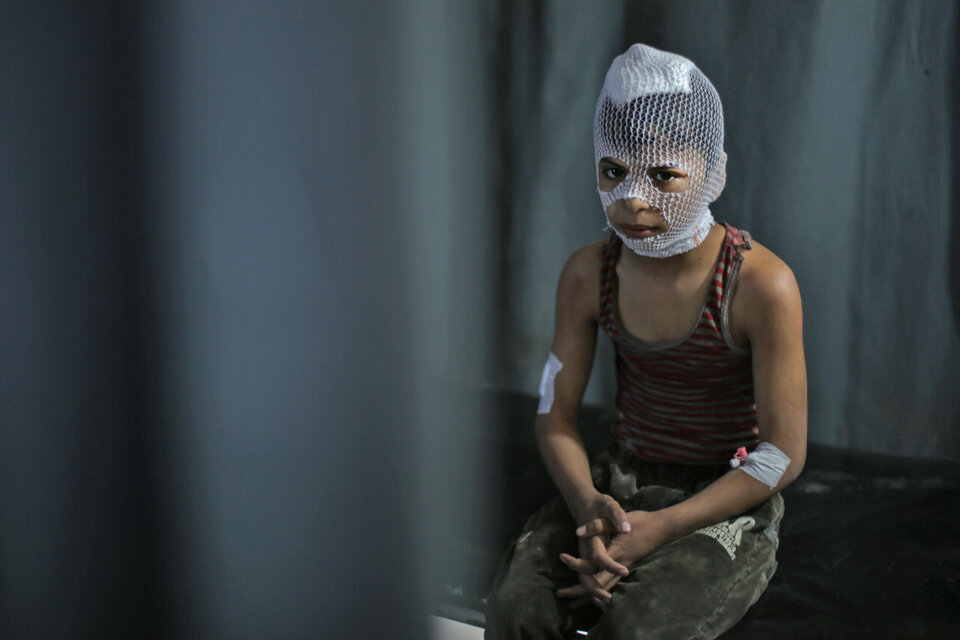 Un niño victima de un bombardeo espera  en una clínica de Maaret Misrin. (Fuente: AFP)