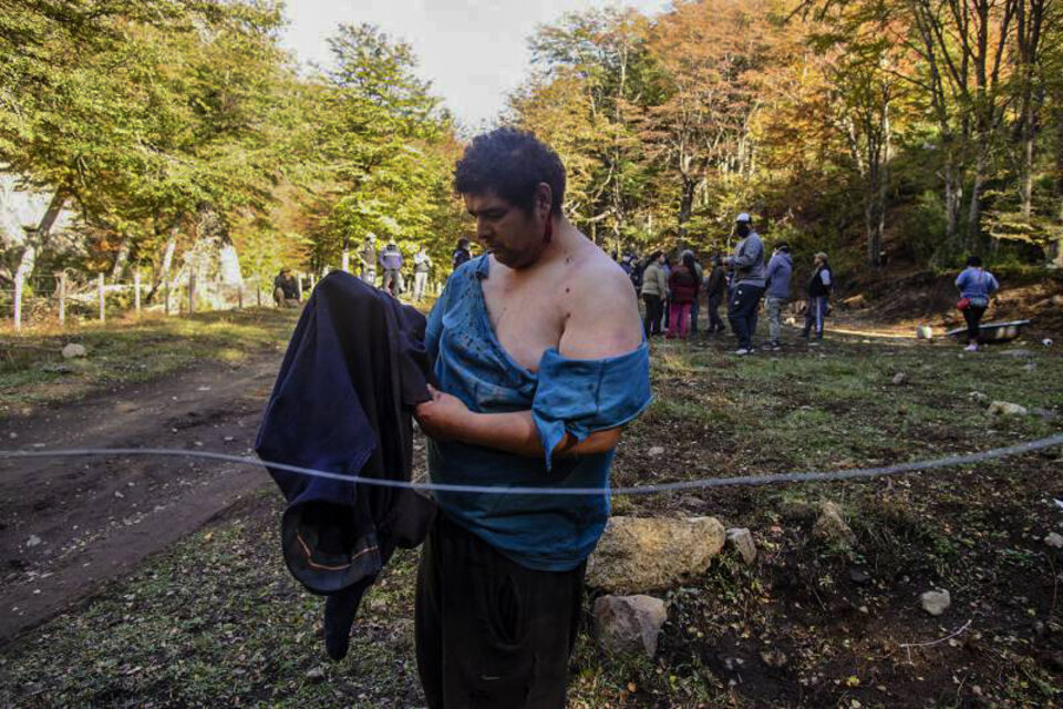 Ramiro Buenuleo fue uno de los agredidos y heridos por los que pretenden expulsarlos de sus tierras.  (Fuente: Marcelo Martínez)