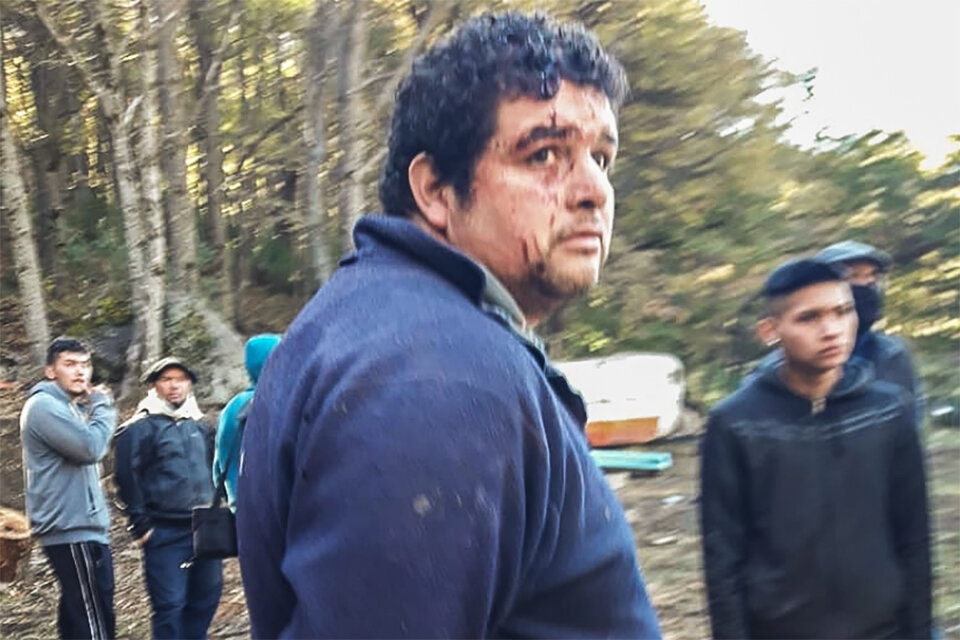 Ramiro Buenuleo, uno de los heridos en la agresión.