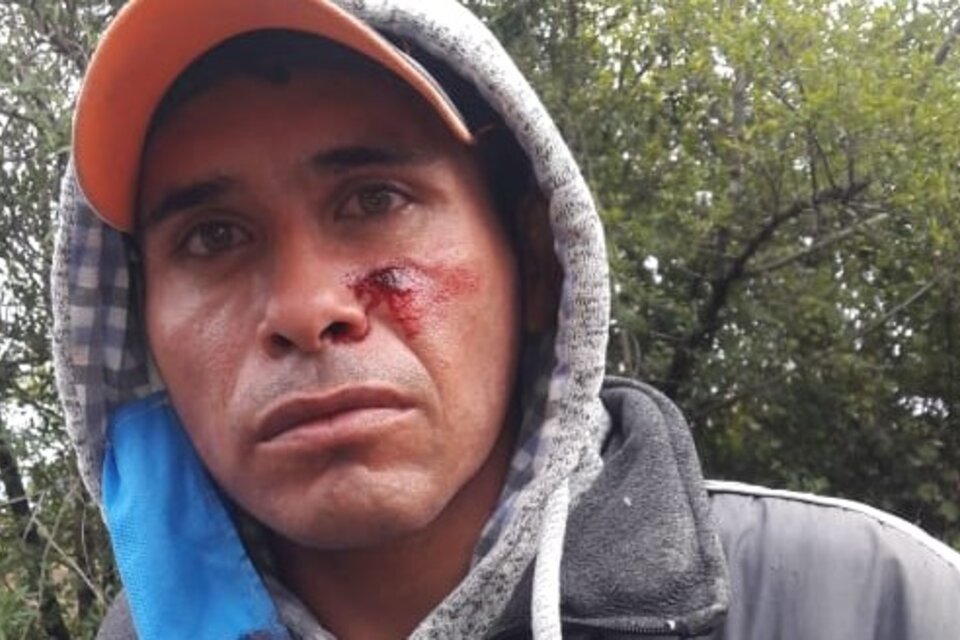 Manifestante herido tras la represión a la protesta del movimiento social 25 de Mayo, en Quitilipi, Chaco. También fueron lesionados integrantes de la Infantería policial de la provincia. 