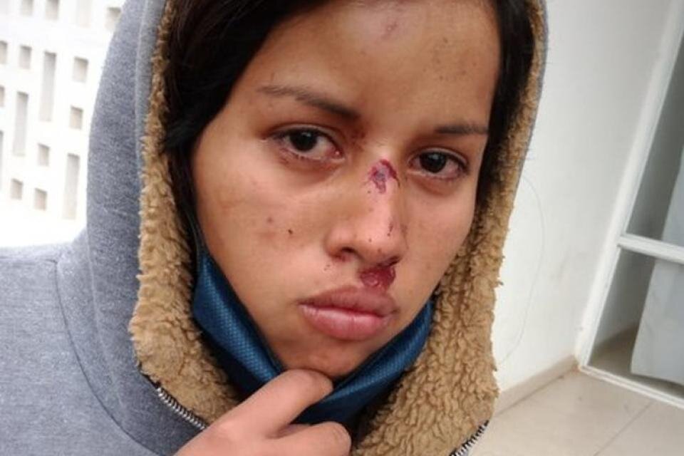 Rebeca Garay, una de las víctimas qom del ataque policial, que está recibiendo contención psicológica y que declararía en breve ante la fiscalía