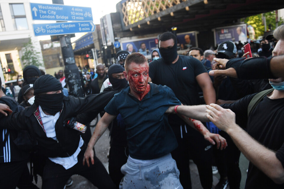 Un contramanifestante herido durante la protesta antirracista en Londres.  (Fuente: EFE)