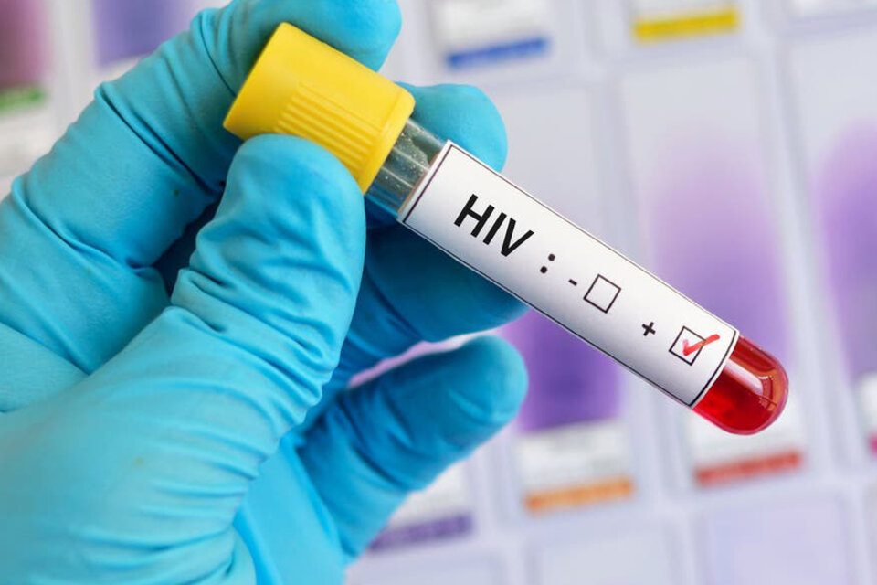 Hay 86.338 pacientes con VIH que se encuentran en tratamiento antirretroviral.