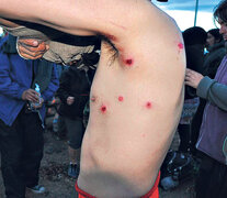 La violenta represión a los mapuches dejó varios heridos, dos de ellos de gravedad.