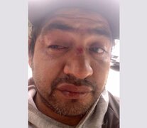 Claudio Astorga, perdió la visión de un ojo por un balazo de goma de la Policía.