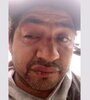 Claudio Astorga, perdió la visión de un ojo por un balazo de goma de la Policía.
