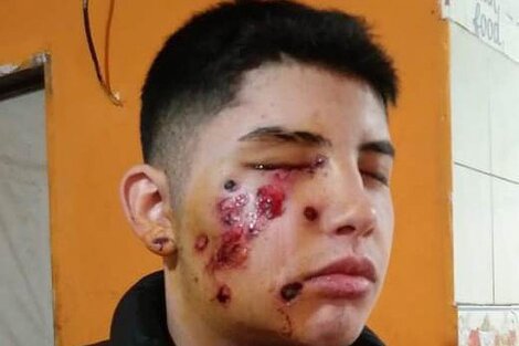 Gatillo fácil: liberan al policía que le disparó en la cara a Ignacio Seijas