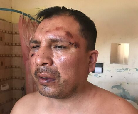 Grave caso de violencia institucional en Mendoza