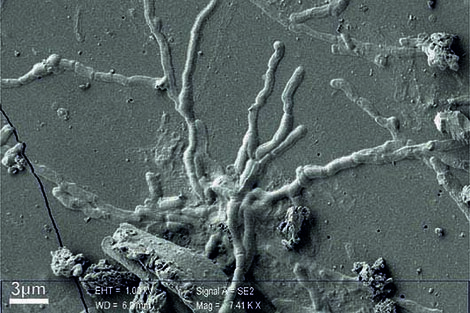 Visualizan neuronas vitrificadas de una víctima de la erupción de Vesubio