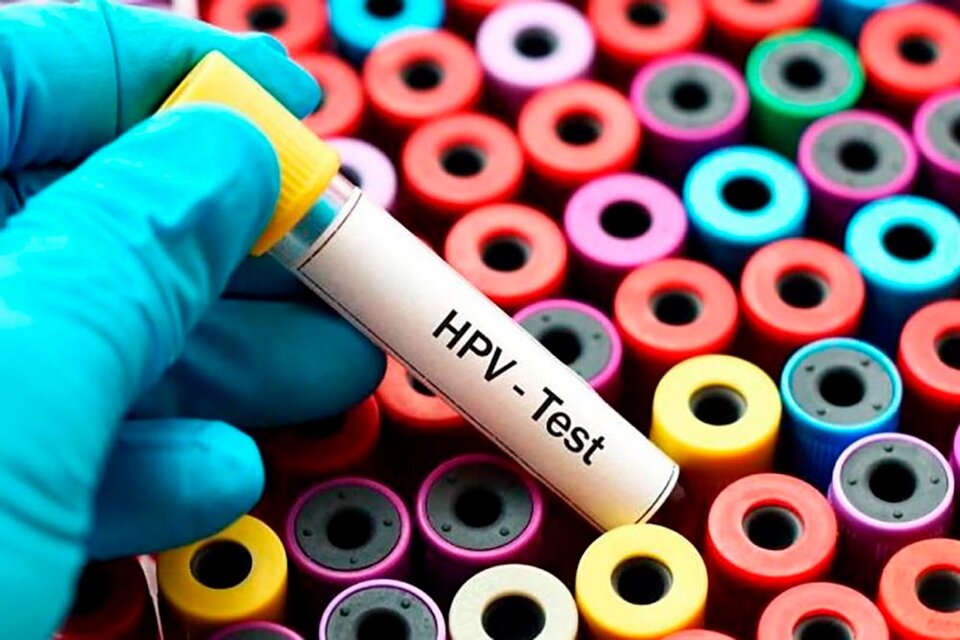 Día mundial del HPV, un virus cancerígeno muy común y poco conocido