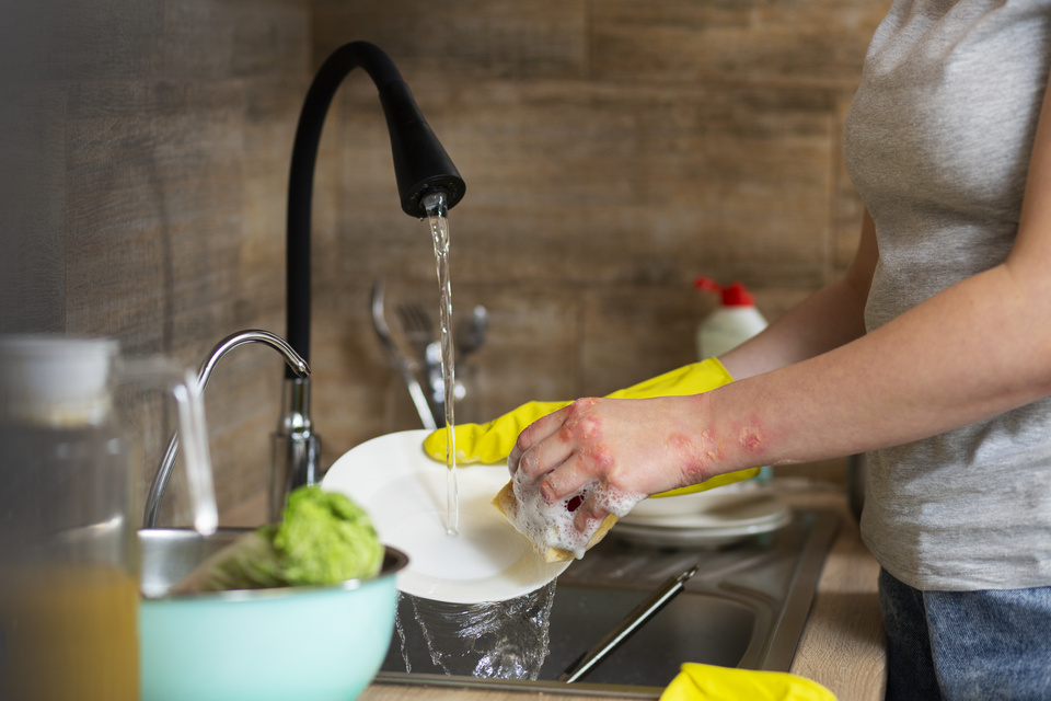 Argentina: Anmat prepovedala prodajo spornega detergenta zaradi opeklin uporabnikov